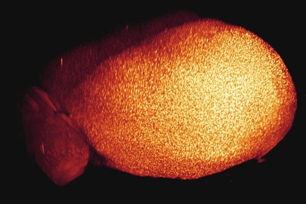 Die hellen Punkte sind Beta-Amyloid-Plaques im Gehirn einer Maus. Sie werden f�r