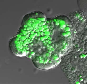 Eine Leberzelle nach sehr fettreicher Ern�hrung, in Verbindung mit Insulinresist