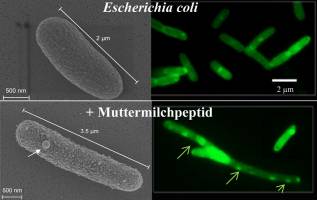 Antibiotikum aus der Muttermilch