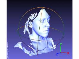 Neue Erkenntnisse zur Gesichtsasymmetrie