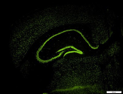 Visualisierung des r�umlichen Expressionsmusters einer speziell im Gehirn angere