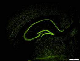 Gr�nes Licht f�r die Angstforschung