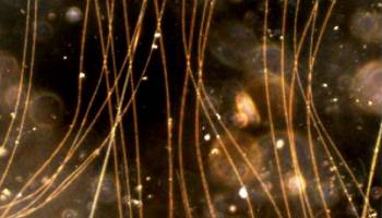 Wenn Strom durch Bakterienkabel flie�t