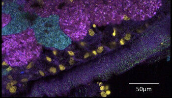 Symbionten ohne Grenzen: Bakterielle Untermieter bereisen die Welt