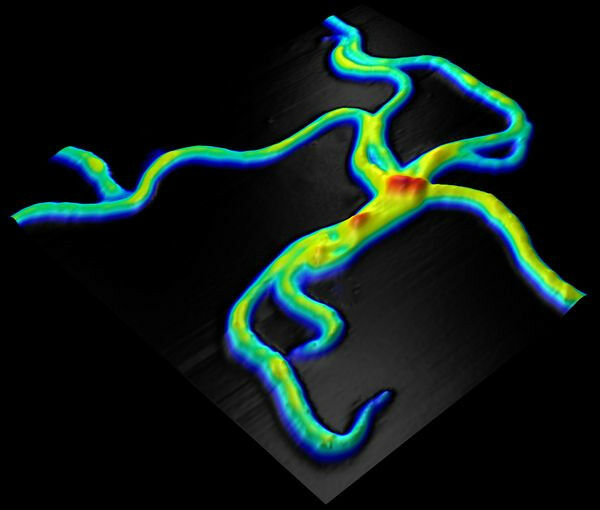 Spirochaete-Rastersondenmikroskopie