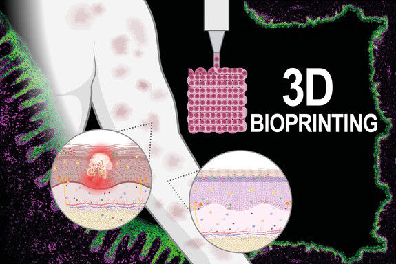 Biological tissue can be formed using 3D printers.