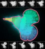 Hitze als Turbo-Antrieb für Immunzellen