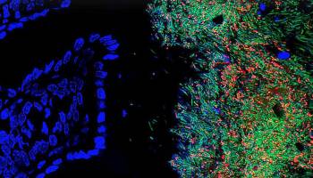 Mikrobiom und Umwelt: Wie sich unser