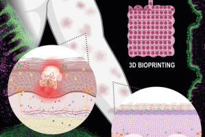 Mit 3D-Druck gegen Hautkrankheiten