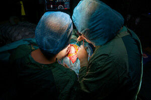 NARvibrain erleichtert Hirntumordiagnostik