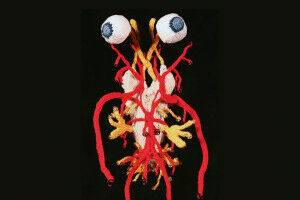 Neue Sonderausstellung im Josephinum - 'Anatomie in Maschen' in Zusammenarbeit mit der K�nstlerin Katharina Sabernig