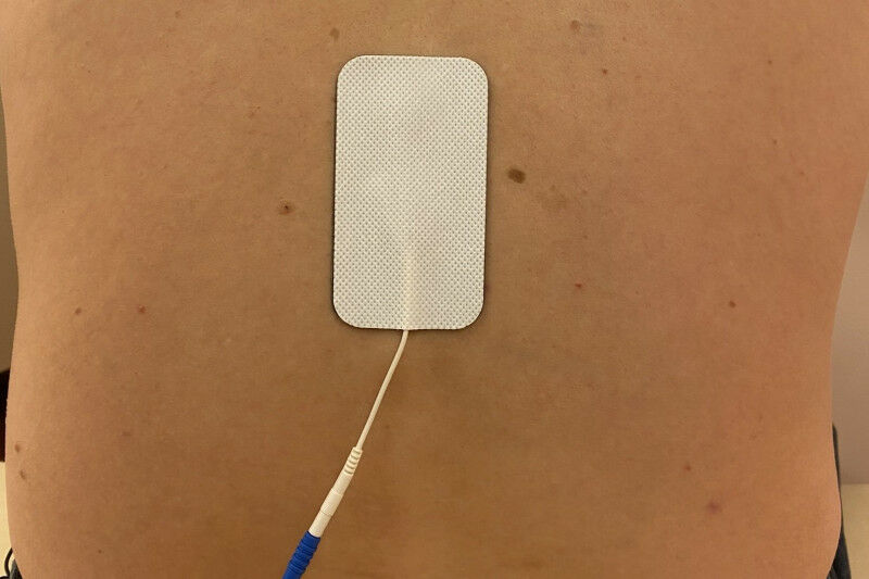 Neuer Therapieansatz bei schwerem COVID-19