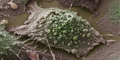 New avenues in lung cancer research with digital cell twin