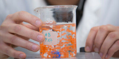 Stoffwechselerkrankungen: 'Research Studio' von Uni Graz und TU Graz