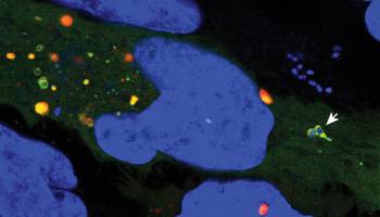 Warum sich Zellen selbst fressen