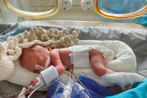 Zur Stelle, wenn ein Leben zu fr�h beginnt